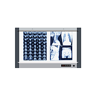 Micare MG-02 Medical film viewer (740*440mm)