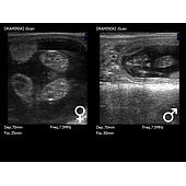 Fetal Sex Determination in Cows During Pregnancy
