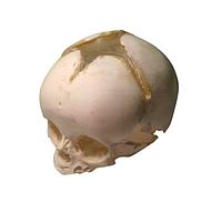 True Phantom Solutions SL-N01 Newborn Skull For X-Ray CT, US, MRI